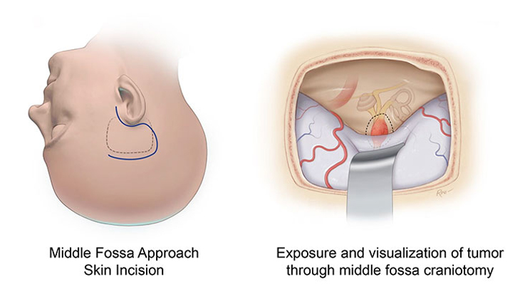 3d illustration of brain and inner ear